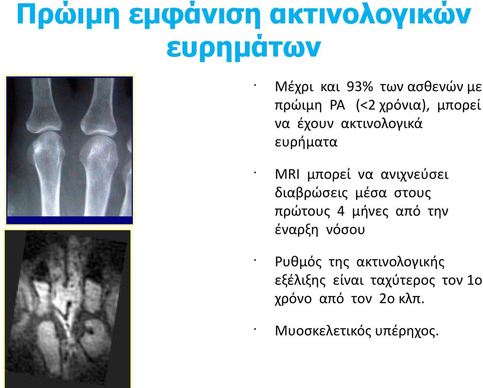 διαβρώσεις μέσα στους πρώτους 4 μήνες από την έναρξη νόσου Ρυθμός της