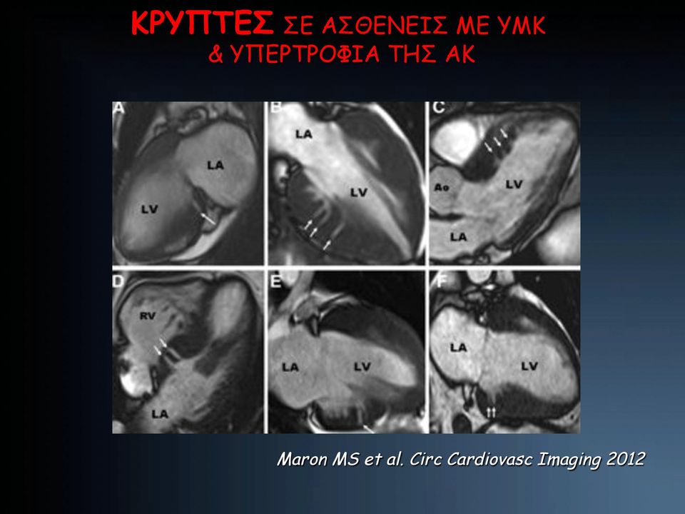ΑΚ Maron MS et al.