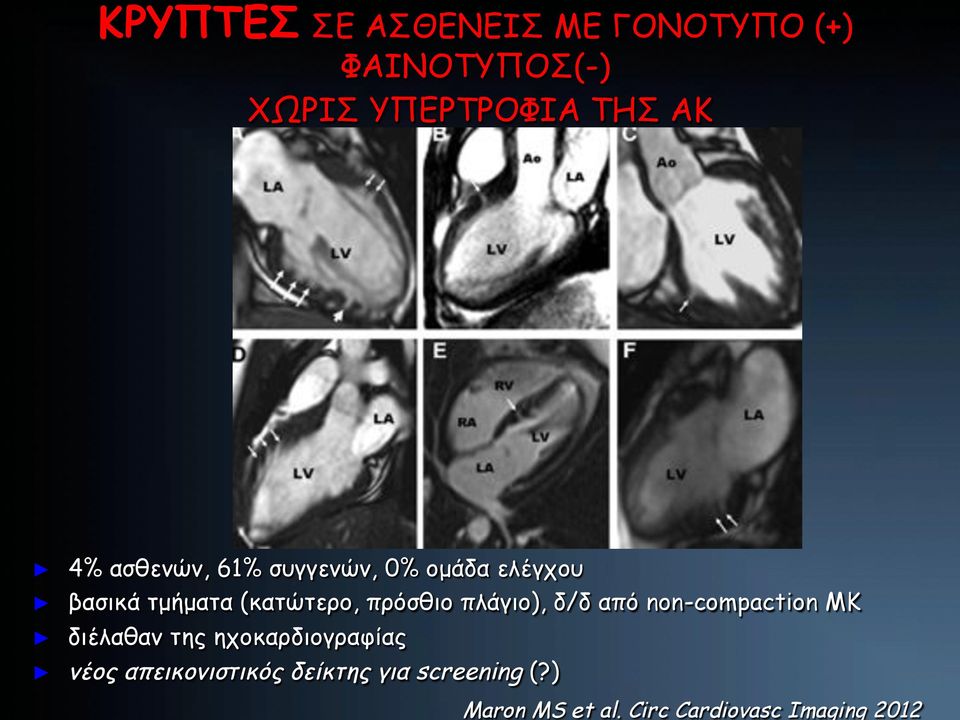 Circ Cardiovasc Imaging 2012 4% ασθενών, 61% συγγενών, 0% οµάδα ελέγχου