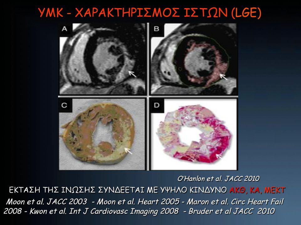 ΜΕΚΤ Moon et al. JACC 2003 - Moon et al. Heart 2005 - Maron et al.