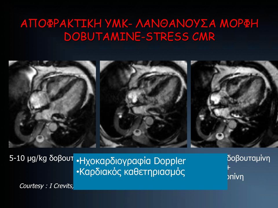 !!!! Courtesy : I Crevits, Belgium Ηχοκαρδιογραφία