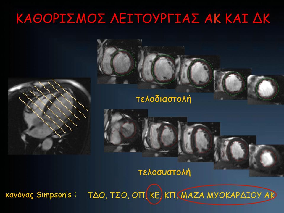 κανόνας Simpson s : ΤΔΟ, ΤΣΟ,