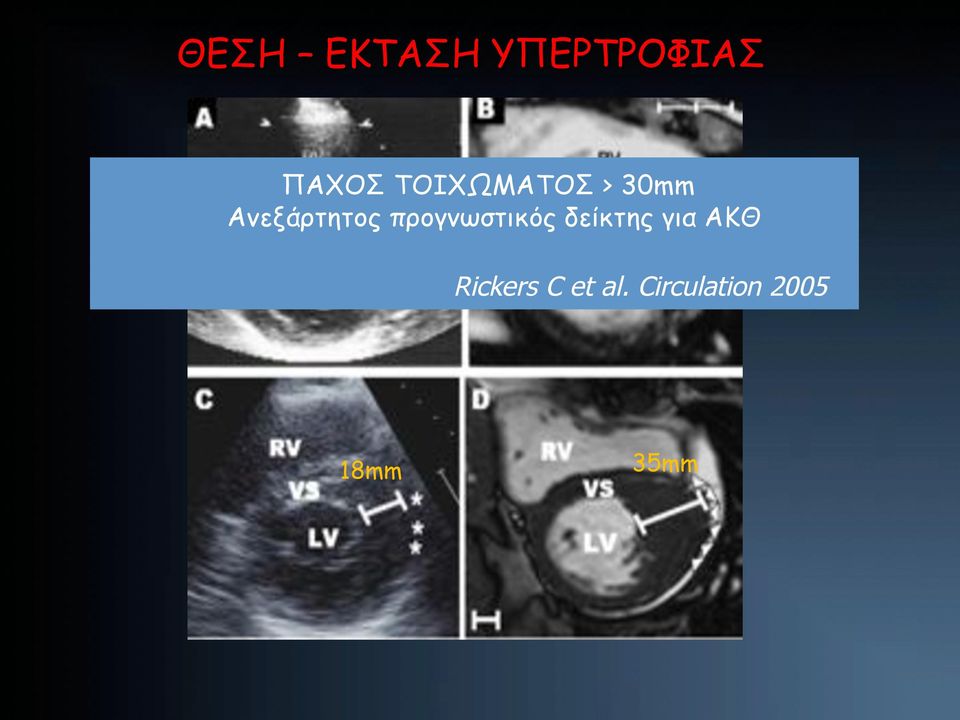 προγνωστικός δείκτης για ΑΚΘ