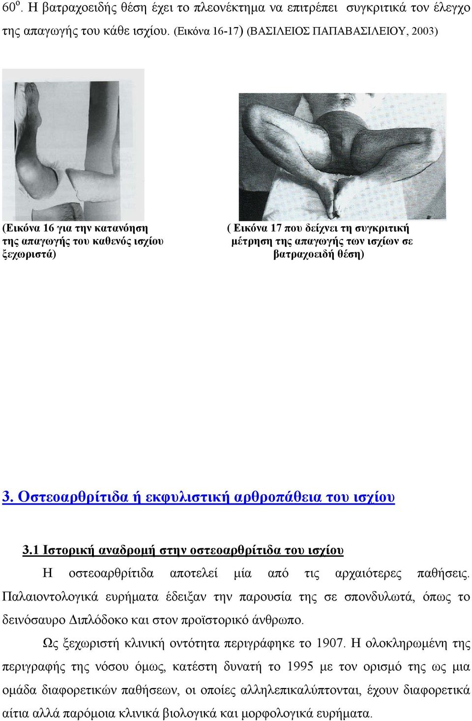 βατραχοειδή θέση) 3. Οστεοαρθρίτιδα ή εκφυλιστική αρθροπάθεια του ισχίου 3.1 Ιστορική αναδρομή στην οστεοαρθρίτιδα του ισχίου Η οστεοαρθρίτιδα αποτελεί μία από τις αρχαιότερες παθήσεις.