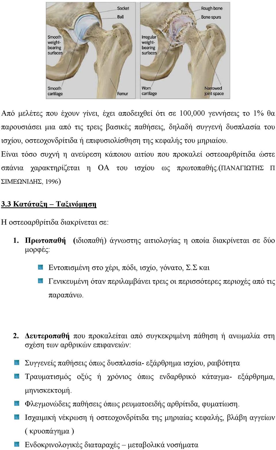 3 Κατάταξη Ταξινόμηση Η οστεοαρθρίτιδα διακρίνεται σε: 1. Πρωτοπαθή (ιδιοπαθή) άγνωστης αιτιολογίας η οποία διακρίνεται σε δύο μορφές: Εντοπισμένη στο χέρι, πόδι, ισχίο, γόνατο, Σ.