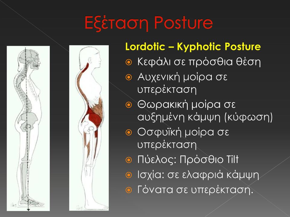 αυξημένη κάμψη (κύφωση) Οσφυϊκή μοίρα σε υπερέκταση