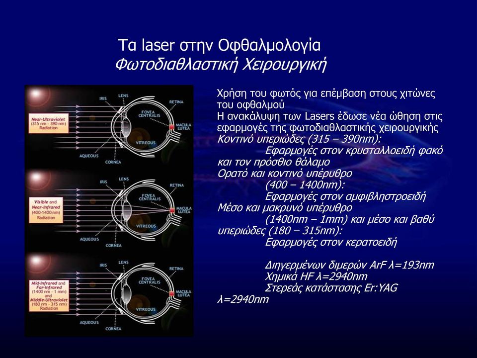 πρόσθιο θάλαμο Ορατό και κοντινό υπέρυθρο (400 1400nm): Εφαρμογές στον αμφιβληστροειδή Μέσο και μακρυνό υπέρυθρο (1400nm 1mm) και μέσο