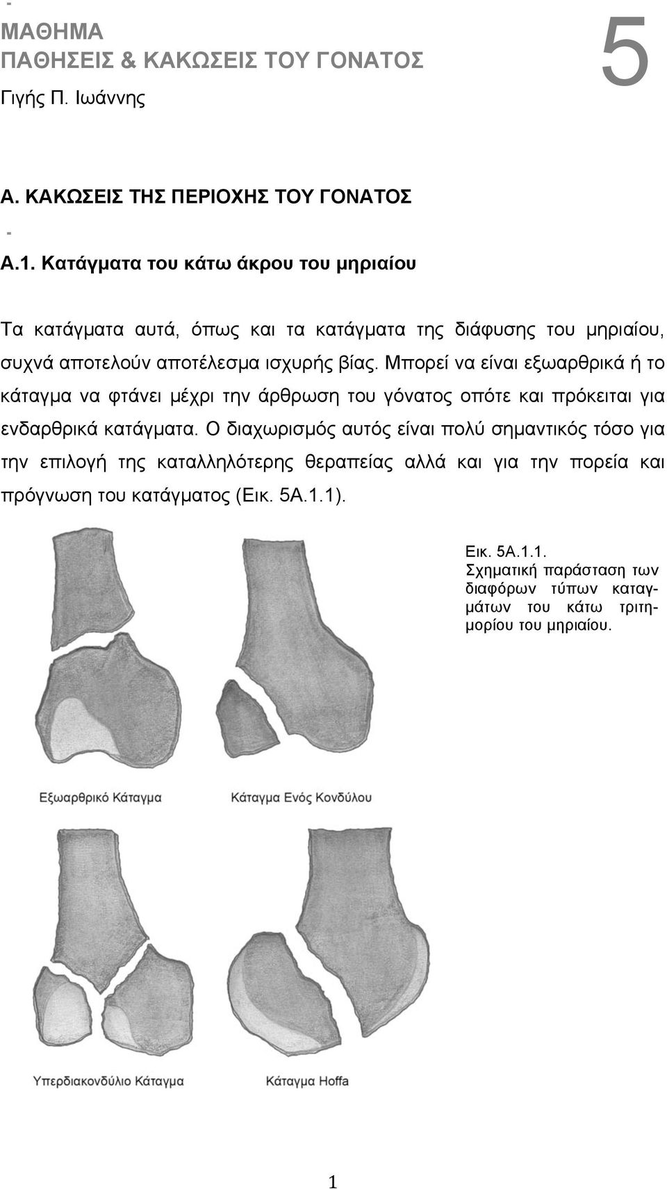 Μπορεί να είναι εξωαρθρικά ή το κάταγµα να φτάνει µέχρι την άρθρωση του γόνατος οπότε και πρόκειται για ενδαρθρικά κατάγµατα.