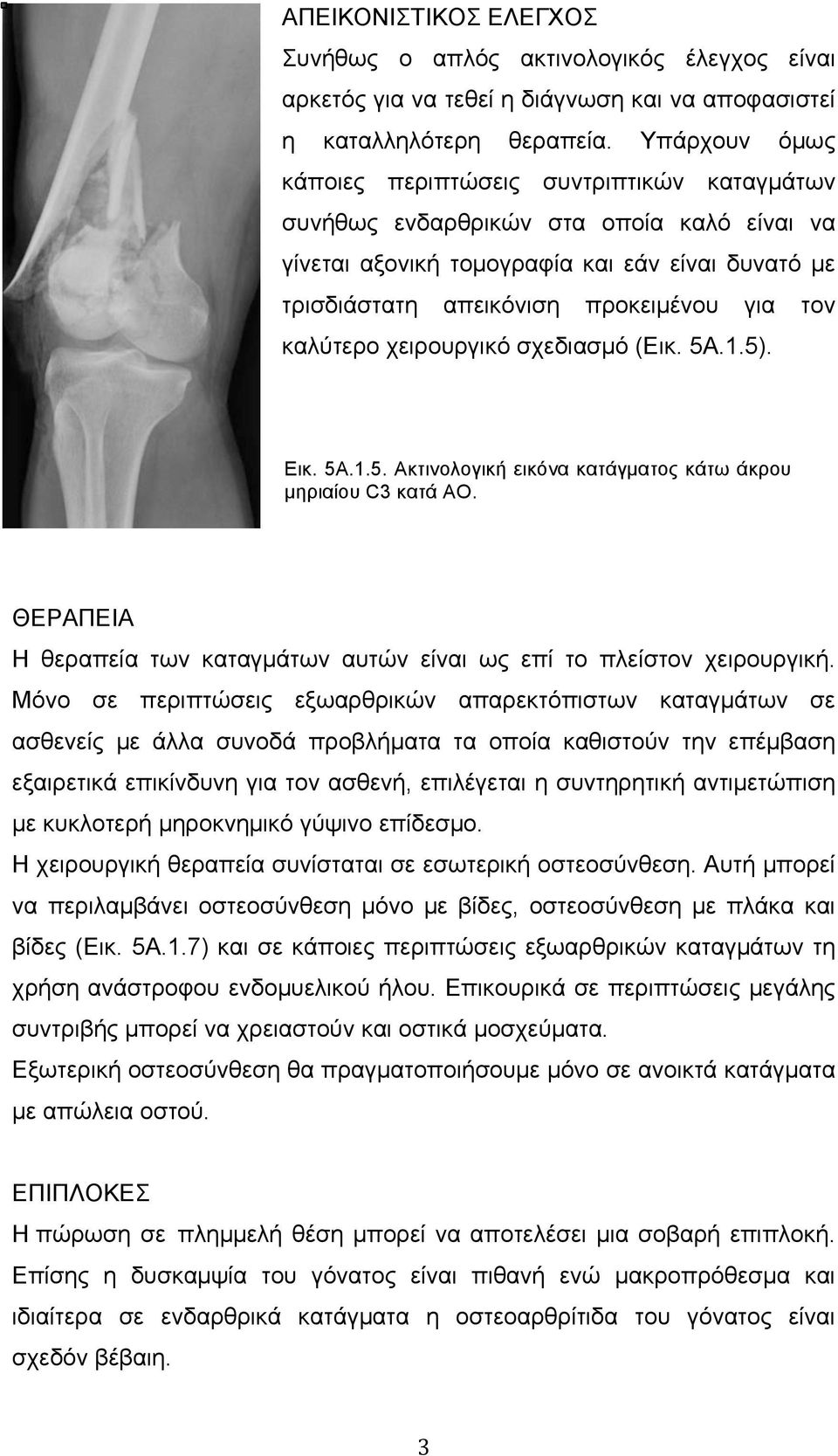 καλύτερο χειρουργικό σχεδιασµό (Εικ. 5Α.1.5). Εικ. 5Α.1.5. Ακτινολογική εικόνα κατάγµατος κάτω άκρου µηριαίου C3 κατά ΑΟ. ΘΕΡΑΠΕΙΑ Η θεραπεία των καταγµάτων αυτών είναι ως επί το πλείστον χειρουργική.