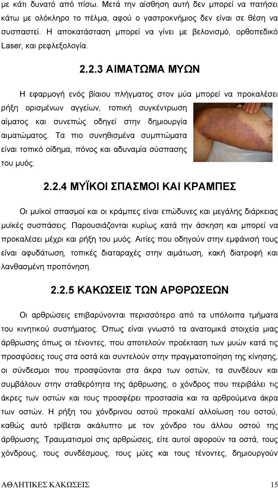 2.3 ΑΙΜΑΤΩΜΑ ΜΥΩΝ Η εφαρμογή ενός βίαιου πλήγματος στον μύα μπορεί να προκαλέσει ρήξη ορισμένων αγγείων, τοπική συγκέντρωση αίματος και συνεπώς οδηγεί στην δημιουργία αιματώματος.