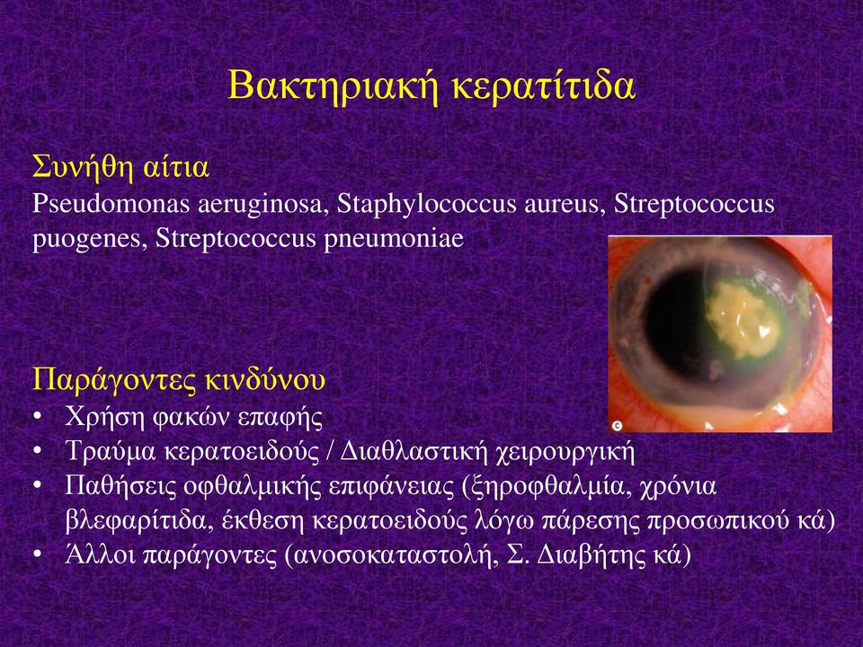 κερατοειδούς / Διαθλαστική χειρουργική Παθήσεις οφθαλμικής επιφάνειας (ξηροφθαλμία, χρόνια
