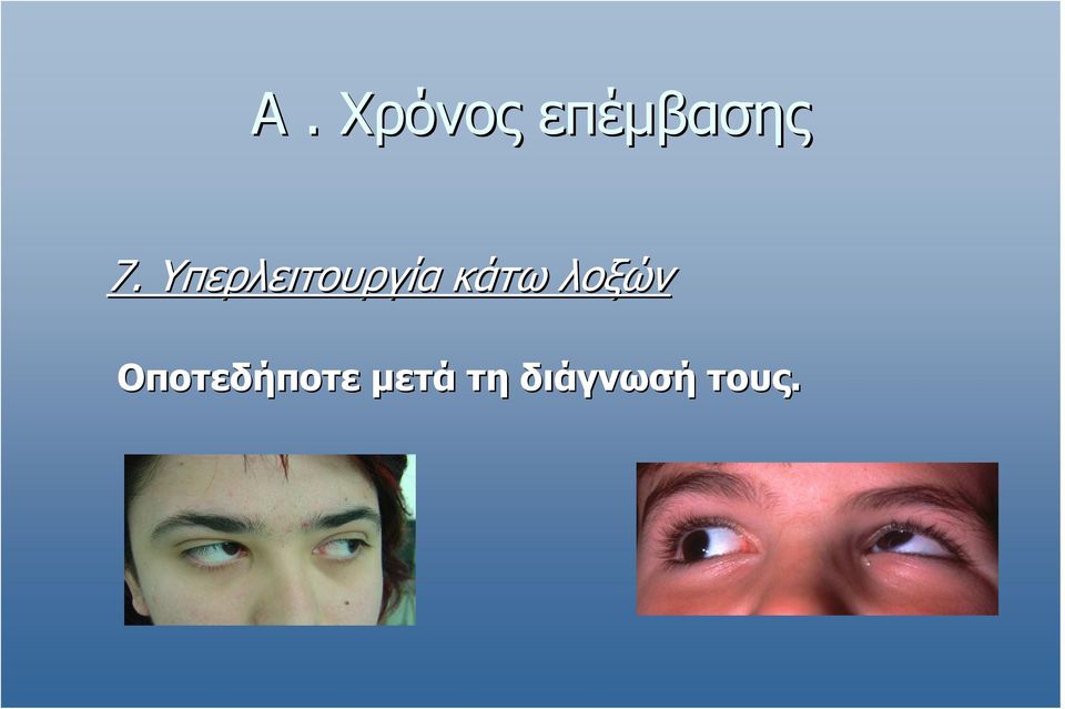 κάτω λοξών