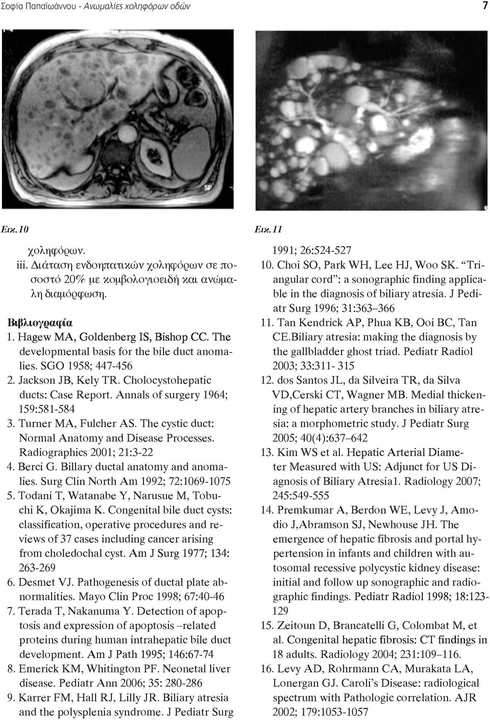 Annal of 1964; 159:581-584 3. Turner MA, Fulcher AS. The duct: Normal Anatomy and. 2001; 21:3-22 4. Berci G. Billary ductal anatomy and anomal. Surg Clin North Am 1992; 72:1069-1075 5.