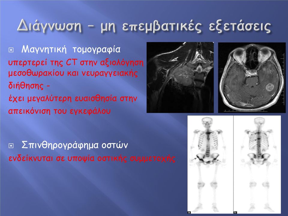 μεγαλύτερη ευαισθησία στην απεικόνιση του εγκεφάλου