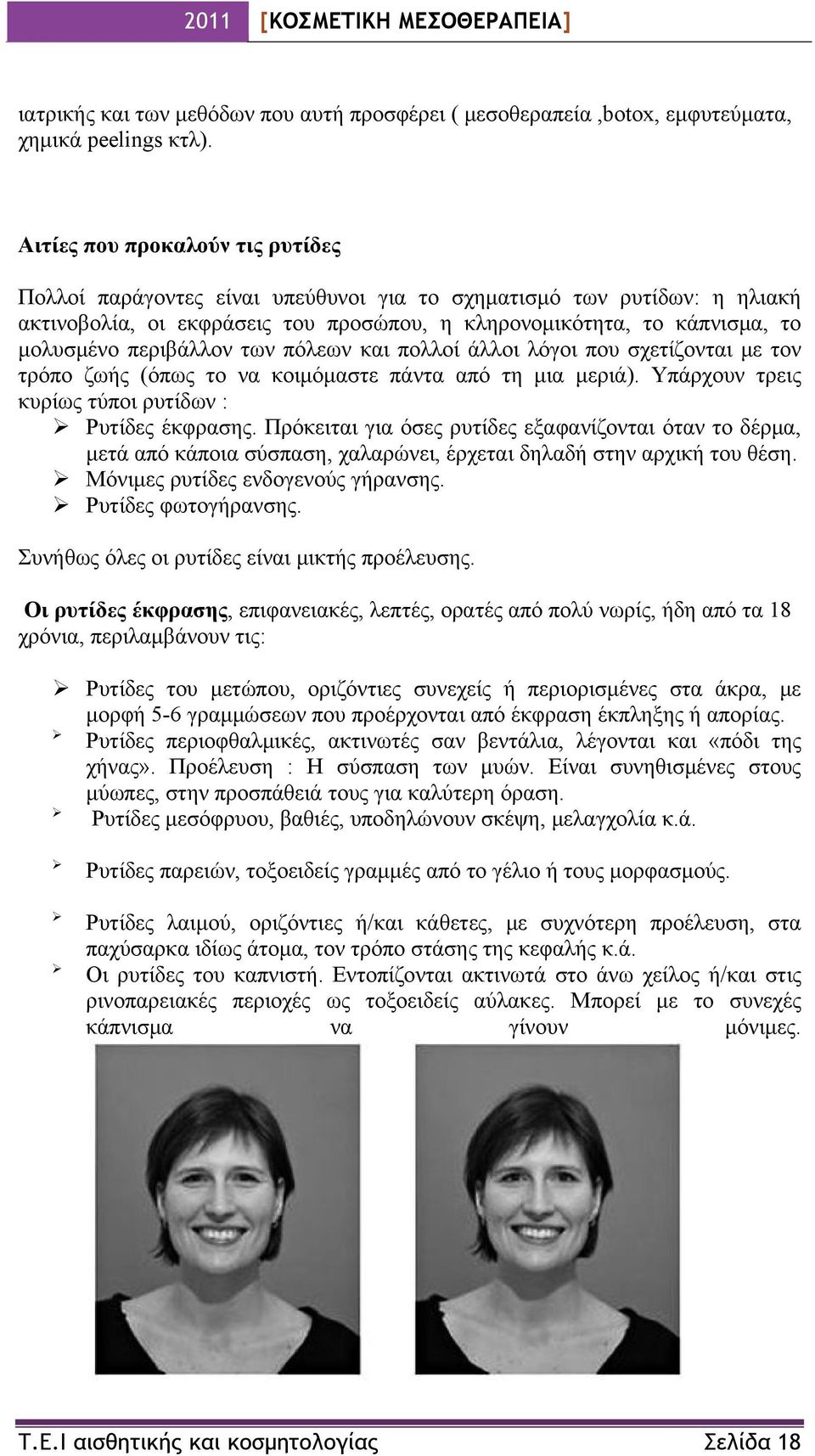 περιβάλλον των πόλεων και πολλοί άλλοι λόγοι που σχετίζονται με τον τρόπο ζωής (όπως το να κοιμόμαστε πάντα από τη μια μεριά). Υπάρχουν τρεις κυρίως τύποι ρυτίδων : Ρυτίδες έκφρασης.