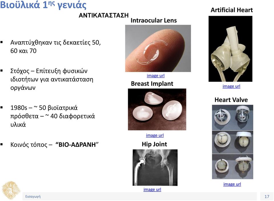 οργάνων image url Breast Implant image url 1980s ~ 50 βιοϊατρικά πρόσθετα ~ 40