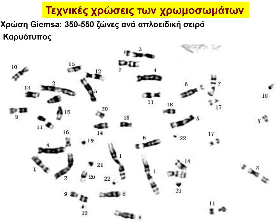 Giemsa: 350-550 ζώνες