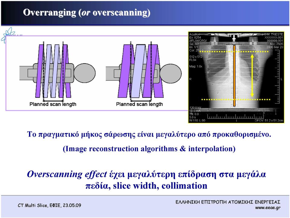 (Image reconstruction algorithms & interpolation)