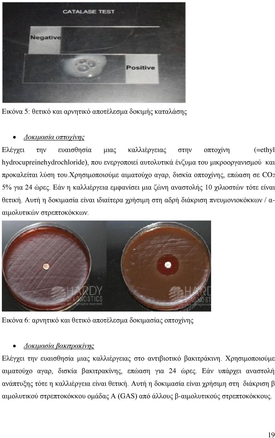 Εάν η καλλιέργεια εμφανίσει μια ζώνη αναστολής 10 χιλιοστών τότε είναι θετική. Αυτή η δοκιμασία είναι ιδιαίτερα χρήσιμη στη αδρή διάκριση πνευμονιοκόκκων / α- αιμολυτικών στρεπτοκόκκων.