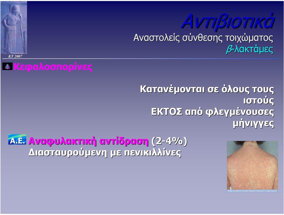 ιστούς από φλεγµένουσες µήνιγγες Α.Ε.
