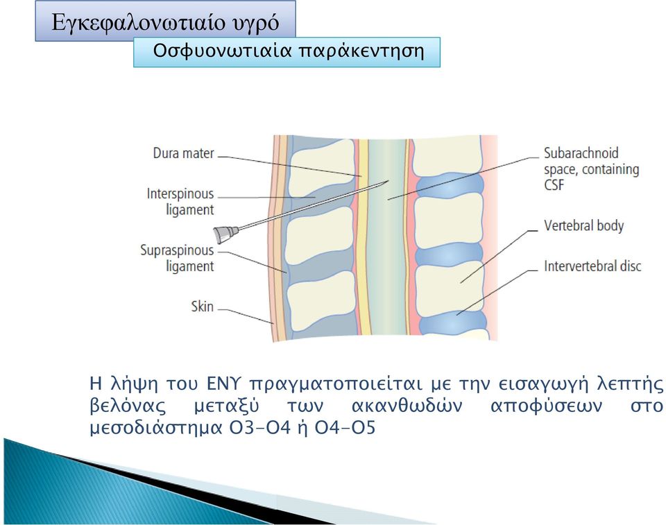 λεπτή βελόνα µεταξύ των ακανθωδών