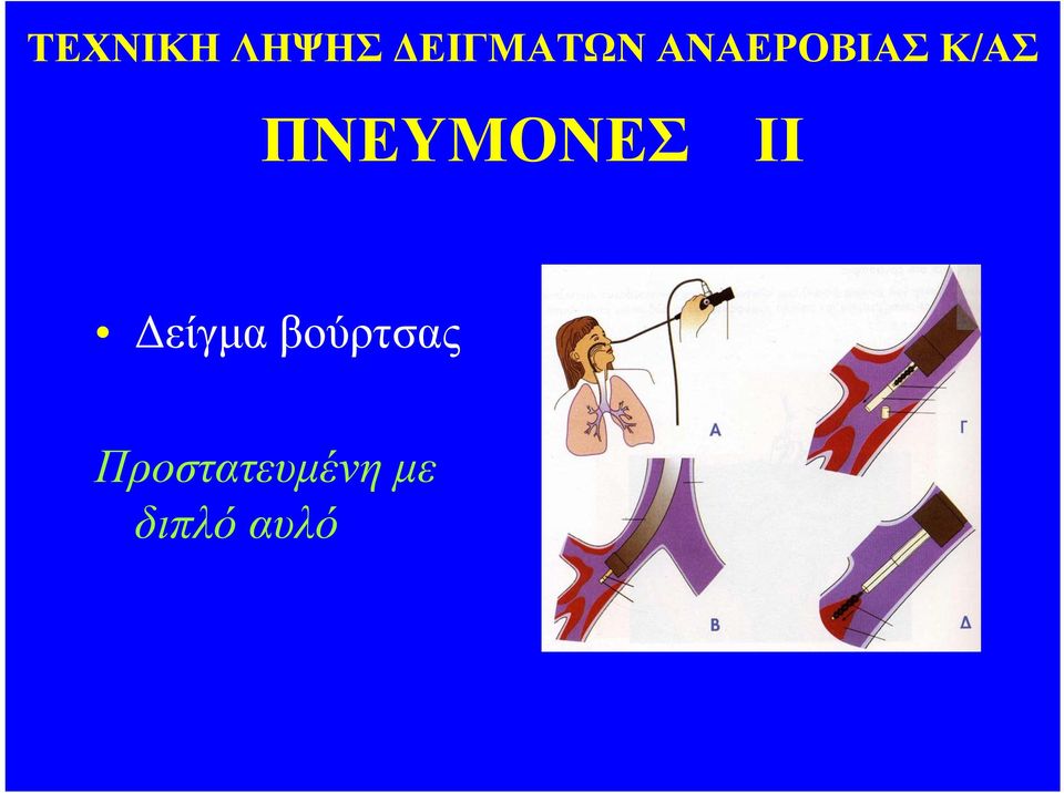 ΠΝΕΥΜΟΝΕΣ ΙΙ Δείγμα