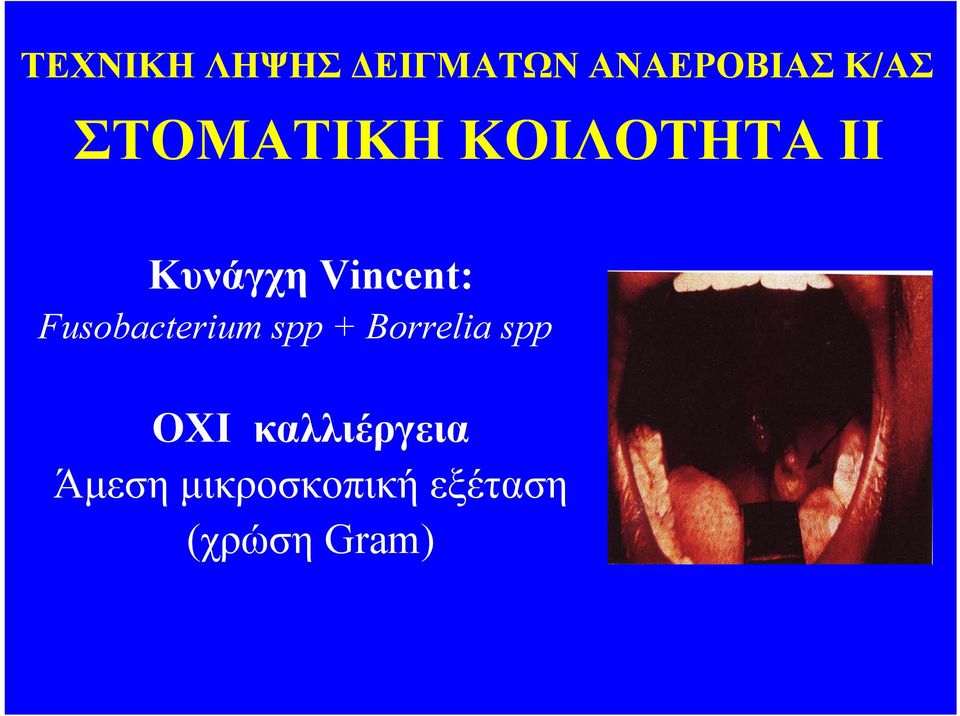 Fusobacterium spp + Borrelia spp ΟΧΙ