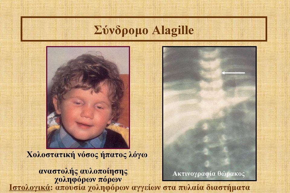 Ακτινογραφία θώρακος χοληφόρων πόρων