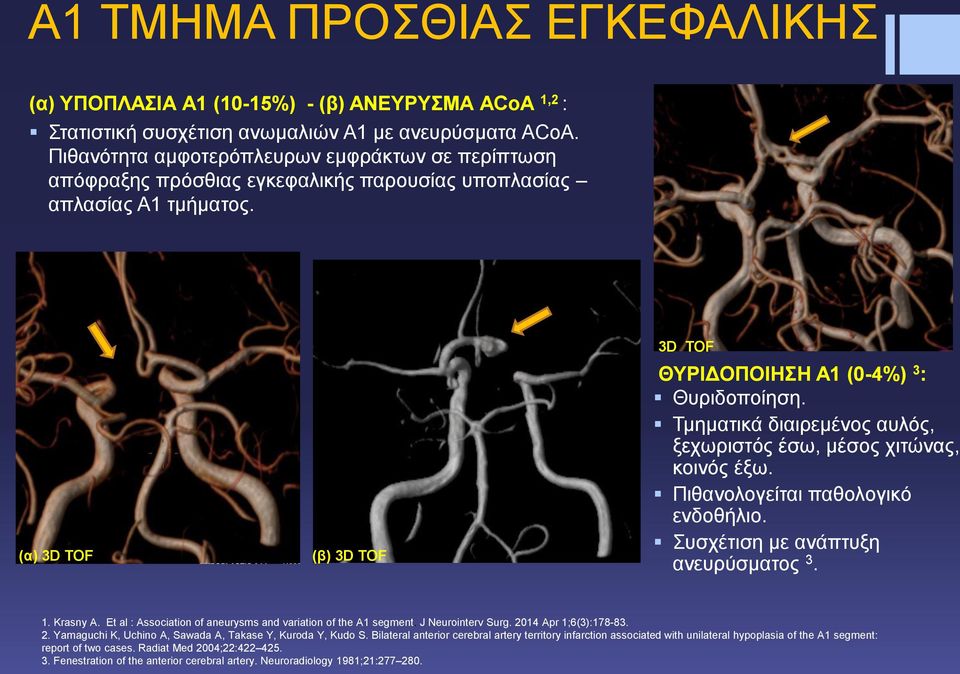 Τμηματικά διαιρεμένος αυλός, ξεχωριστός έσω, μέσος χιτώνας, κοινός έξω. Πιθανολογείται παθολογικό ενδοθήλιο. Συσχέτιση με ανάπτυξη ανευρύσματος 3. 1. Krasny A.