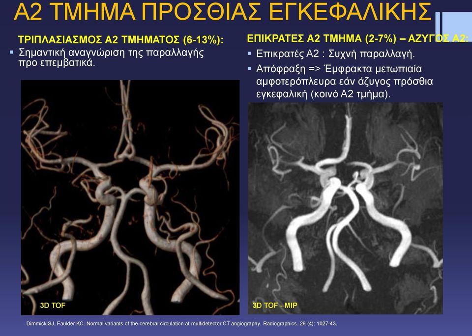 Απόφραξη => Έμφρακτα μετωπιαία αμφοτερόπλευρα εάν άζυγος πρόσθια εγκεφαλική (κοινό Α2 τμήμα).
