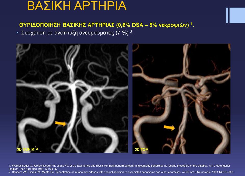 Experience and result with postmortem cerebral angiography performed as routine procedure of the autopsy.