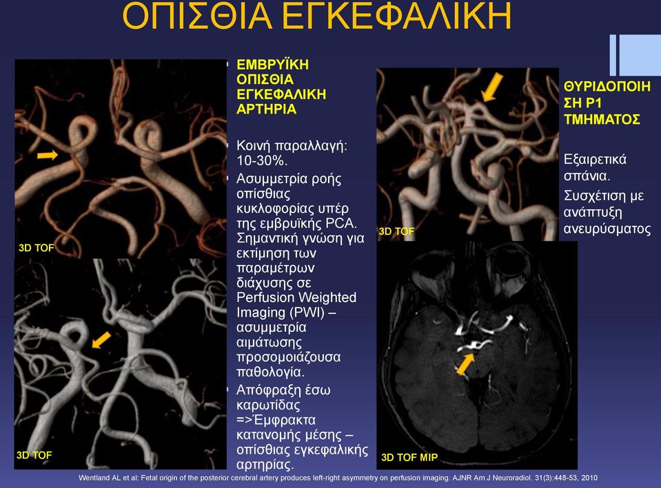 Σημαντική γνώση για εκτίμηση των παραμέτρων διάχυσης σε Perfusion Weighted Imaging (PWI) ασυμμετρία αιμάτωσης προσομοιάζουσα παθολογία.