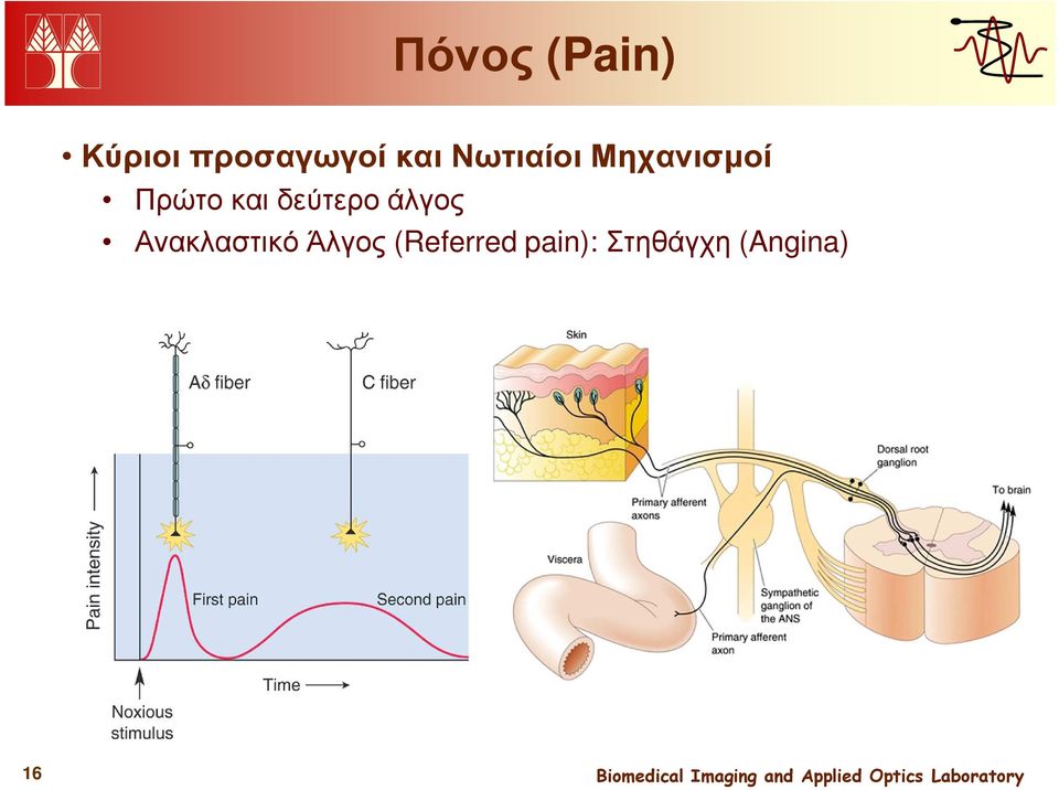 δεύτερο άλγος Ανακλαστικό Άλγος