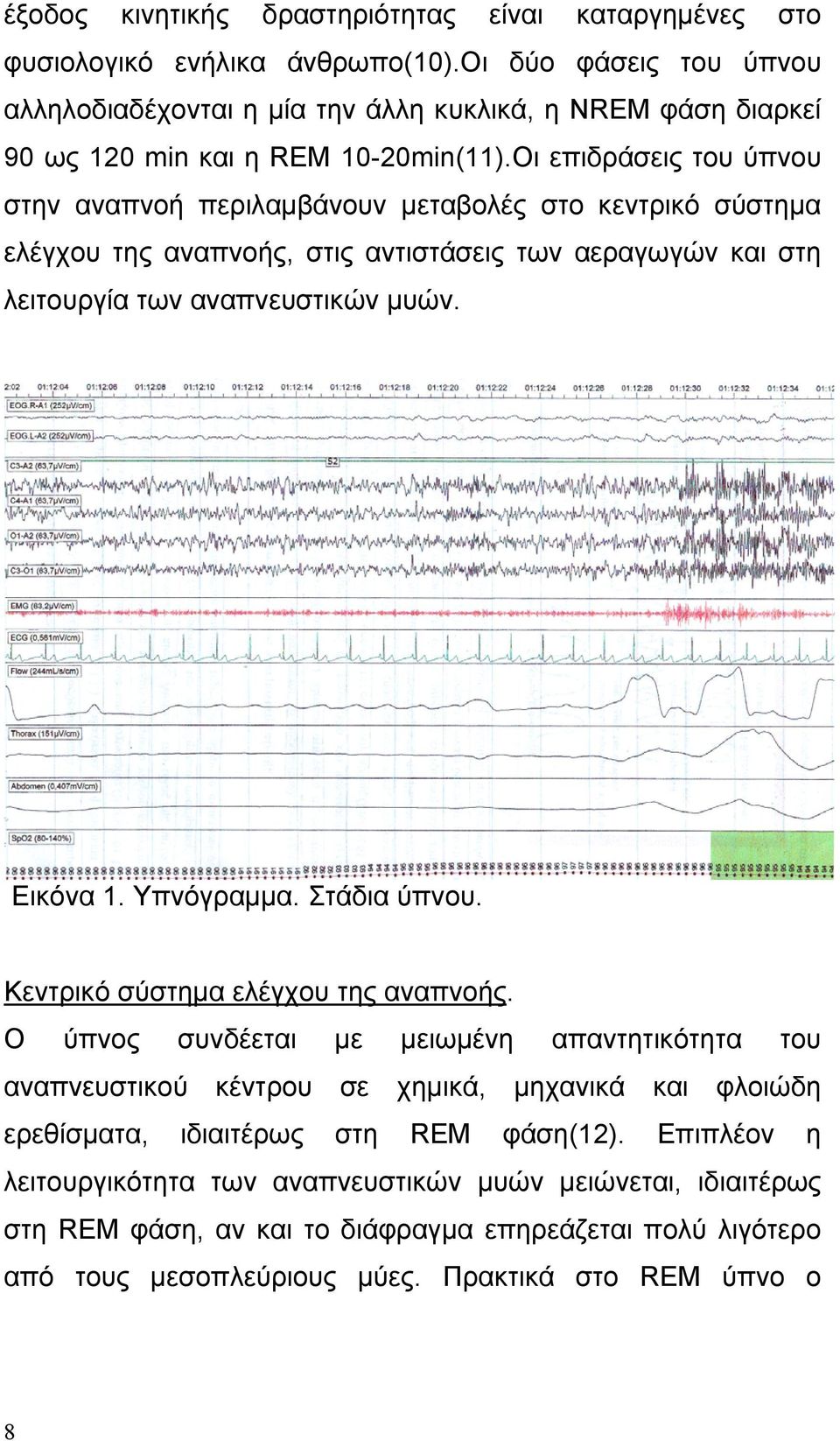 Οι επιδράσεις του ύπνου στην αναπνοή περιλαμβάνουν μεταβολές στο κεντρικό σύστημα ελέγχου της αναπνοής, στις αντιστάσεις των αεραγωγών και στη λειτουργία των αναπνευστικών μυών. Εικόνα 1. Υπνόγραμμα.