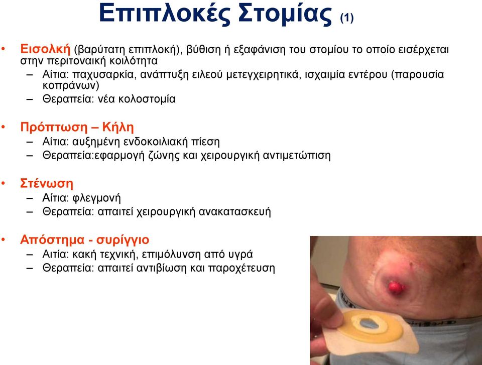 Αίτια: αυξημένη ενδοκοιλιακή πίεση Θεραπεία:εφαρμογή ζώνης και χειρουργική αντιμετώπιση Στένωση Αίτια: φλεγμονή Θεραπεία: