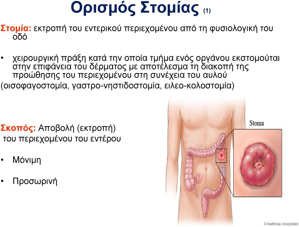 αποτέλεσμα τη διακοπή της προώθησης του περιεχομένου στη συνέχεια του αυλού (οισοφαγοστομία,