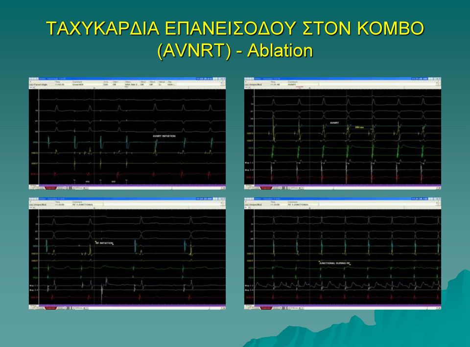 ΣΤΟΝ ΚΟΜΒΟ