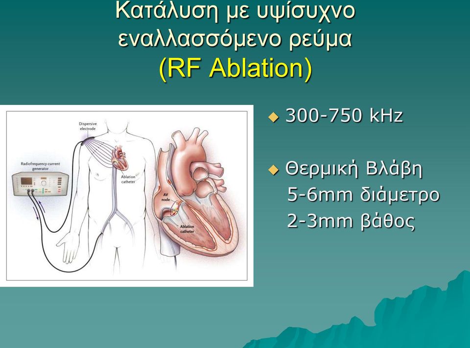 Ablation) 300-750 khz