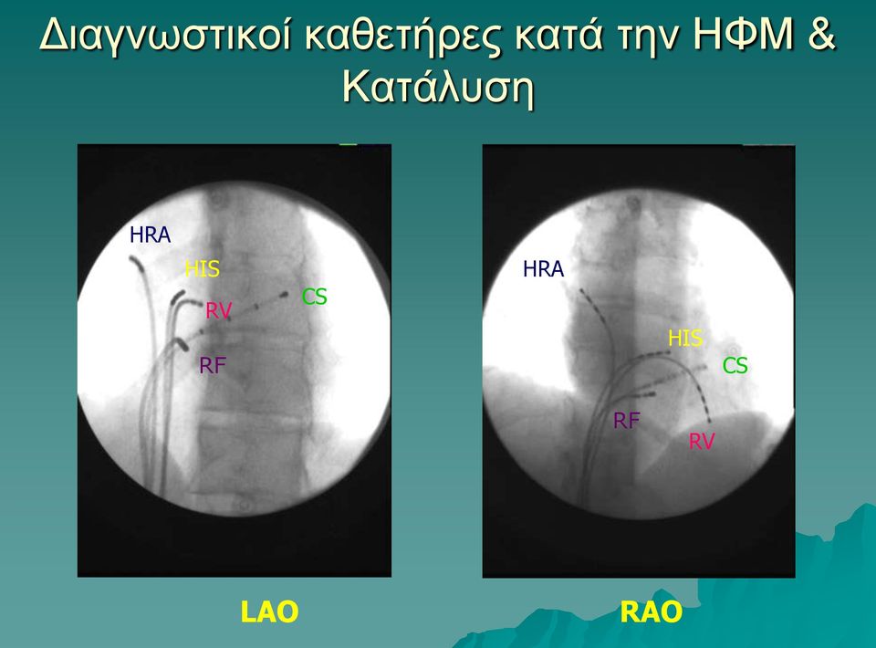 ΗΦΜ & Κατάλυση HRA