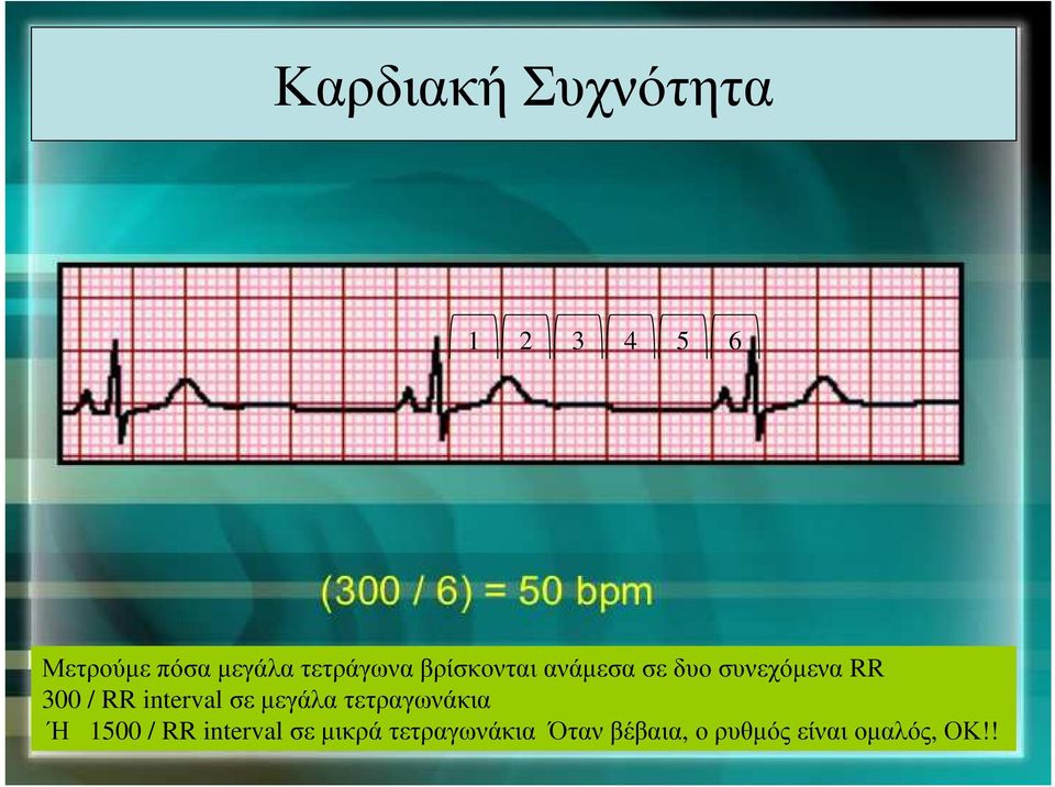 RR interval σε µεγάλα τετραγωνάκια Ή 1500 / RR interval