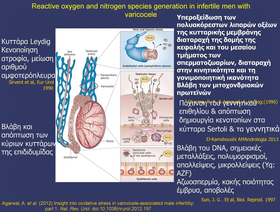 Insight into oxidative stress in varicocele-associated male infertility: part 1. Nat. Rev. Urol. doi:10.1038/nrurol.2012.