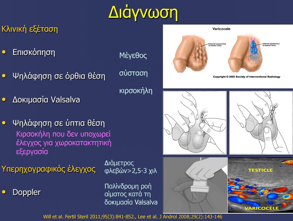 εξεργασία Υπερηχογραφικός έλεγχος Διάµετρος φλεβών>2,5-3 χιλ Doppler Παλίνδροµη ροή αίµατος κατά