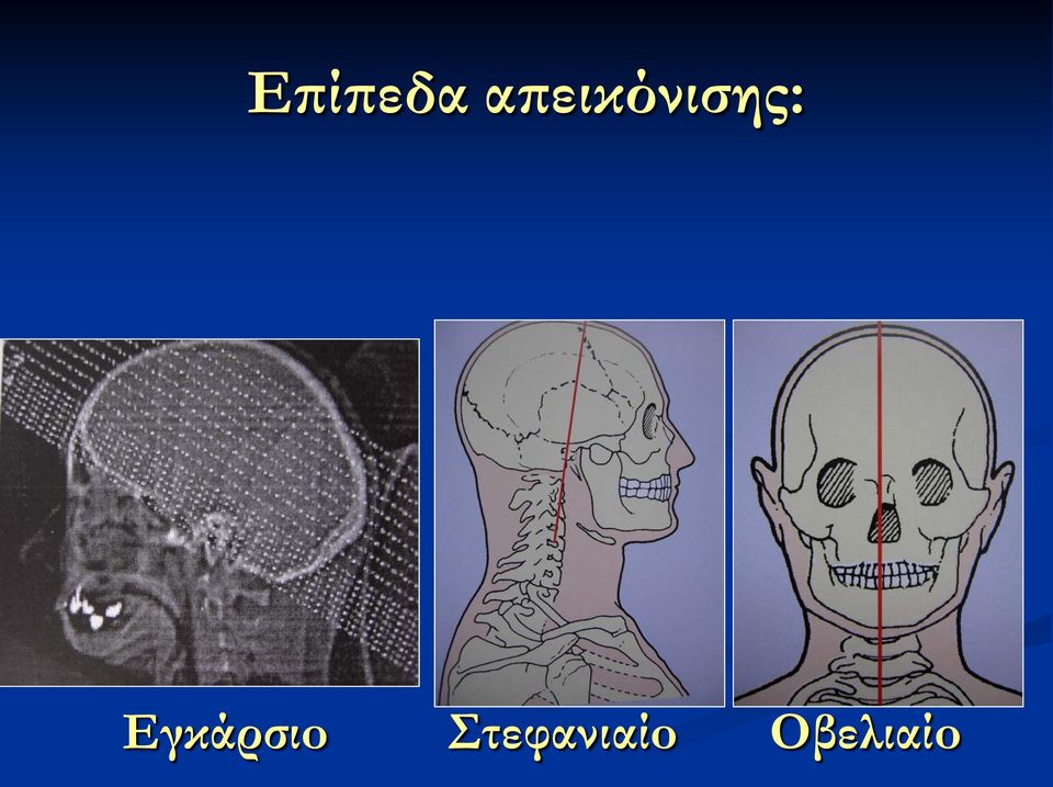 Εγκάρσιo