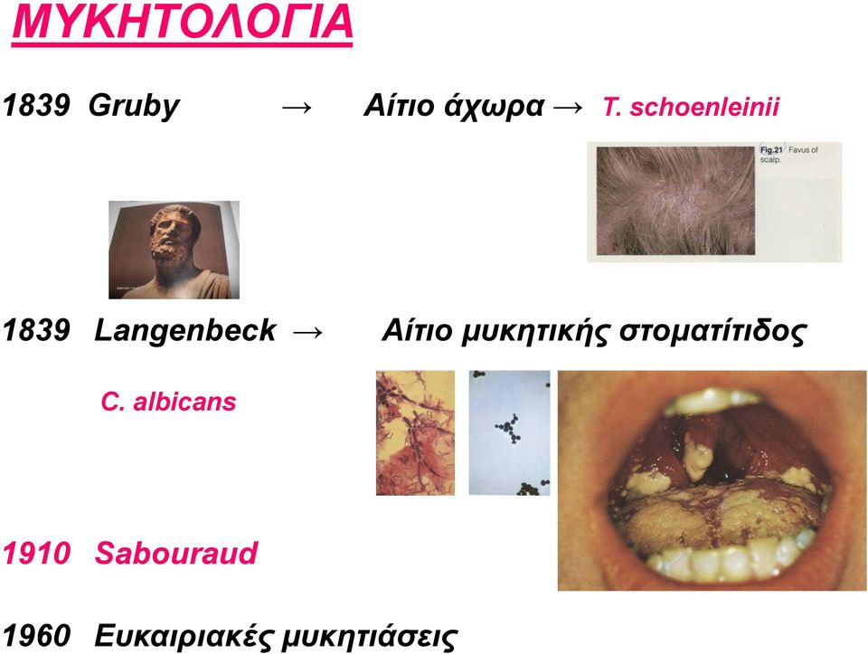 μυκητικής στοματίτιδος C.