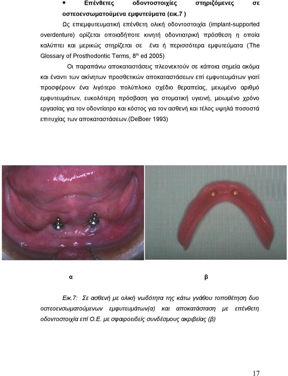 εμφυτεύματα (The th Glossary of Prosthodontic Terms, 8 ed 200) Οι παραπάνω αποκαταστάσεις πλεονεκτούν σε κάποια σημεία ακόμα και έναντι των ακίνητων προσθετικών αποκαταστάσεων επί εμφυτευμάτων γιατί