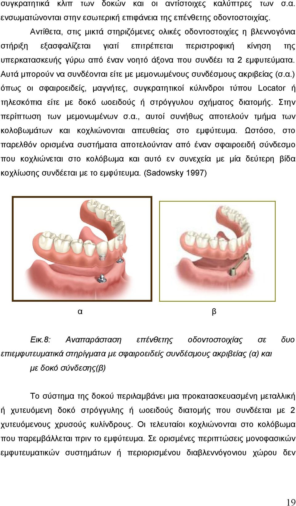 εμφυτεύματα. Αυτά μπορούν να συνδέονται είτε με μεμονωμένους συνδέσμους ακριβείας (σ.α.) όπως οι σφαιροειδείς, μαγνήτες, συγκρατητικοί κύλινδροι τύπου Locator ή τηλεσκόπια είτε με δοκό ωοειδούς ή στρόγγυλου σχήματος διατομής.