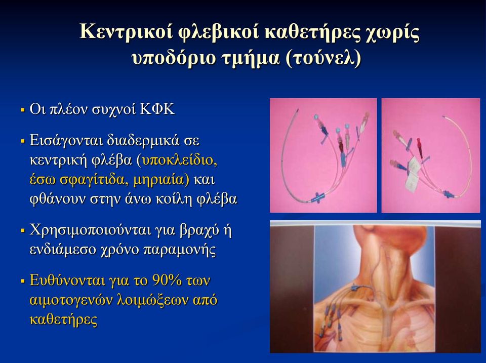 μηριαία) και φθάνουν στην άνω κοίλη φλέβα Χρησιμοποιούνται για βραχύ ή