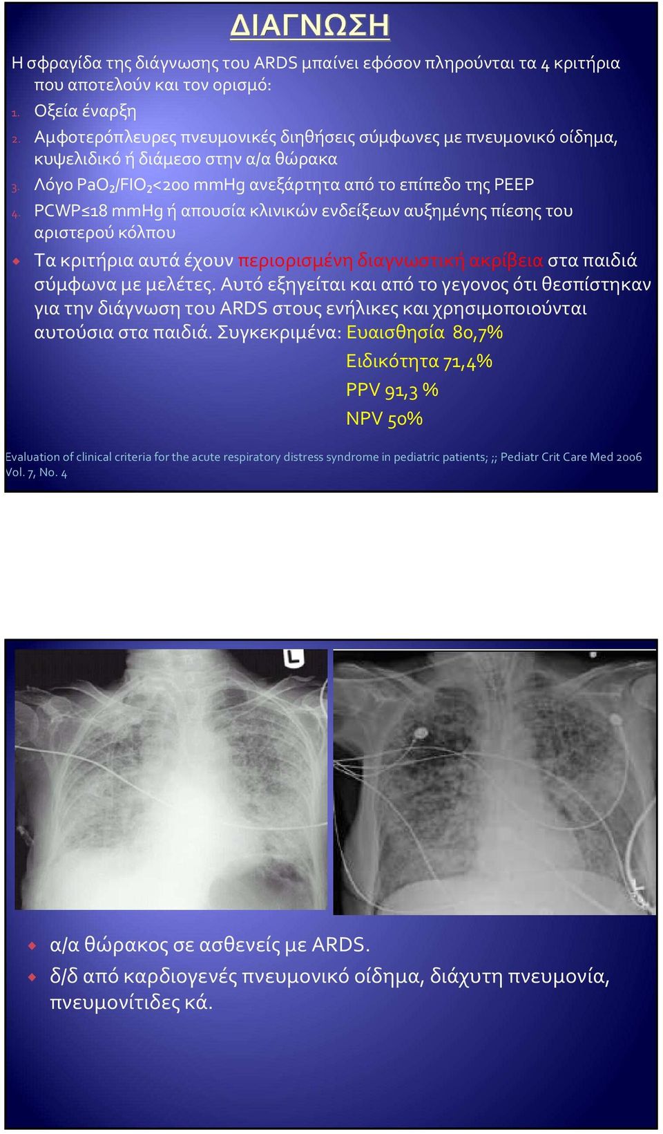 PCWP 18 mmhg ή απουσία κλινικών ενδείξεων αυξημένης πίεσης του αριστερού κόλπου Τα κριτήρια αυτά έχουν περιορισμένη διαγνωστική ακρίβεια στα παιδιά σύμφωνα με μελέτες.