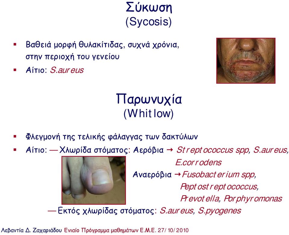 στόματος: Αερόβια Streptococcus spp, S.aureus, E.