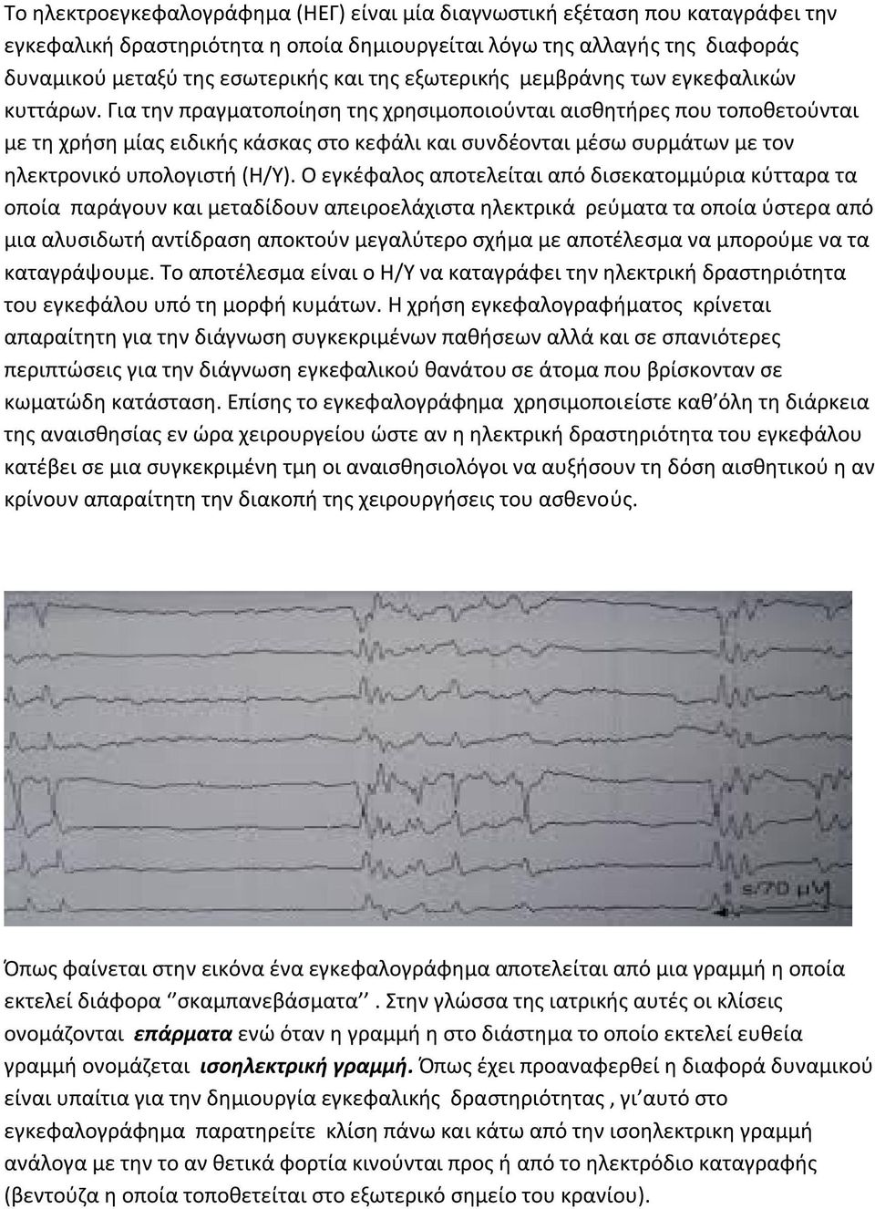 Για την πραγματοποίηση της χρησιμοποιούνται αισθητήρες που τοποθετούνται με τη χρήση μίας ειδικής κάσκας στο κεφάλι και συνδέονται μέσω συρμάτων με τον ηλεκτρονικό υπολογιστή (Η/Υ).